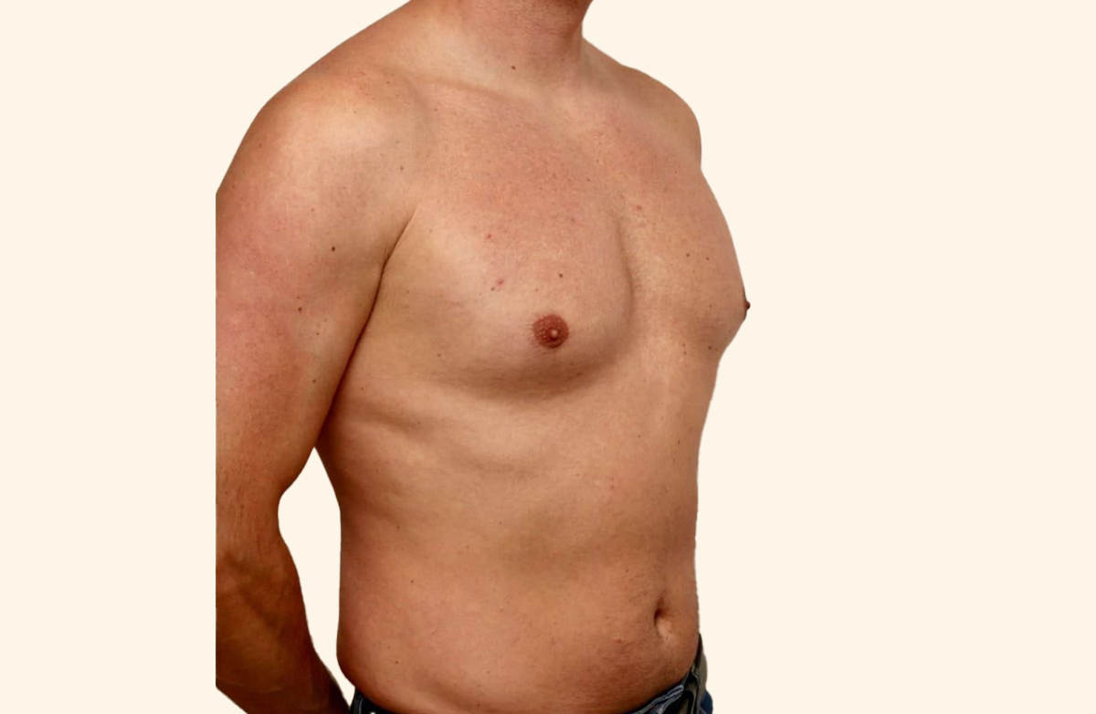 Treatment by Dr. Sami Salahia