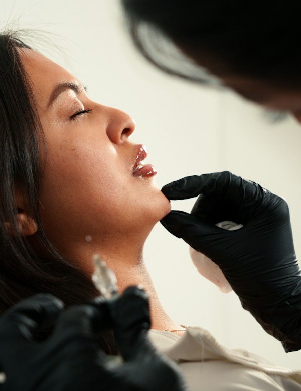 Before chin filler treatment