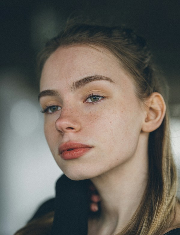 Before dermal filler treatment