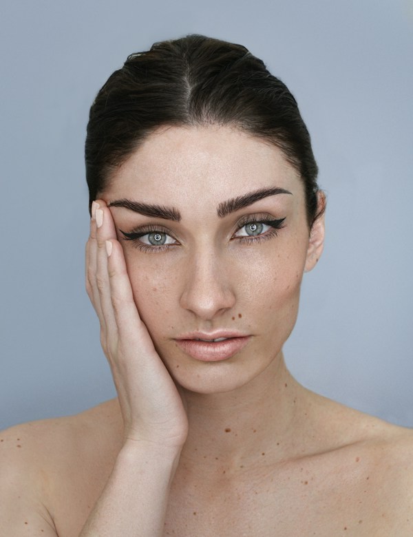 Before profhilo treatment